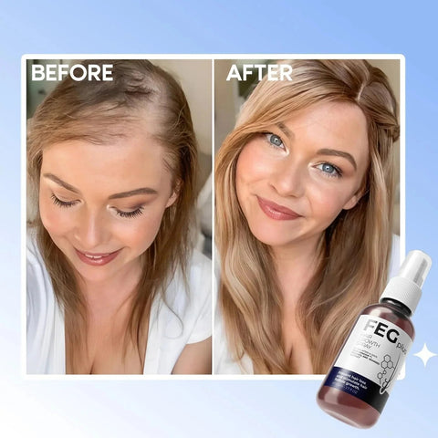 FEG PLUS Hair Growth Spray