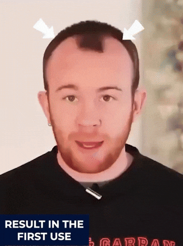FEG PLUS Hair Growth Spray